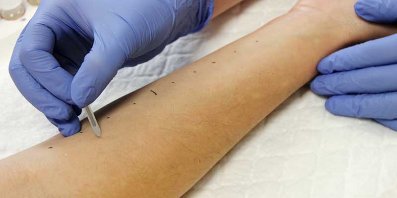 Pautas para que los pacientes diferencien  la alergia primaveral de la infección por COVID-19