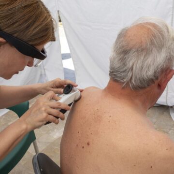 Dermatóloga realizando una revisión durante las Jornadas de Prevención y Detección Precoz del Cáncer de Piel en la Playa de La Mata de Torrevieja